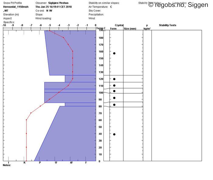 Image Of Snow Profile