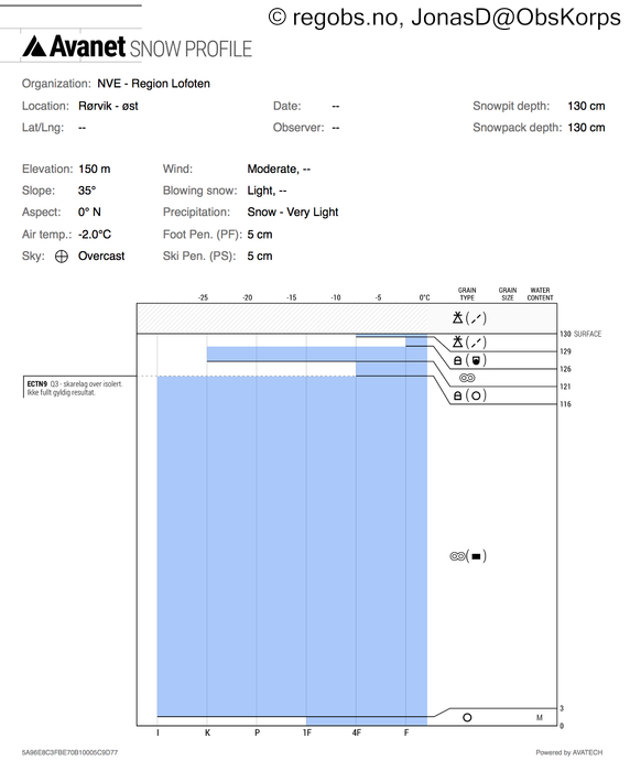 Image Of Snow Profile