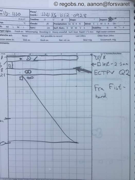 Image Of Snow Profile